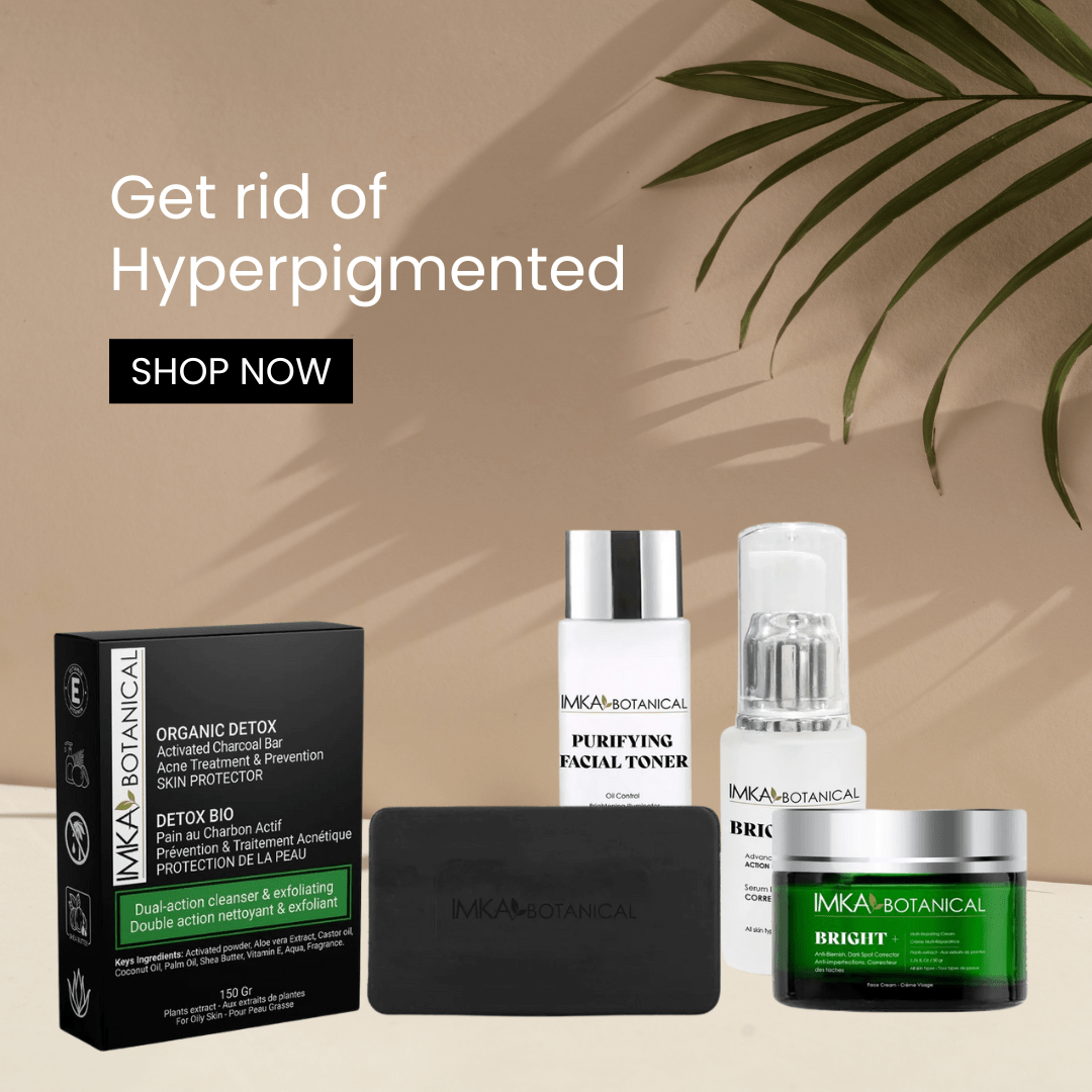 Anti - Blemish cream, Dark Spot Corrector, Hyperpigmentation cream - ShanShar Beauty : The world of beauty.