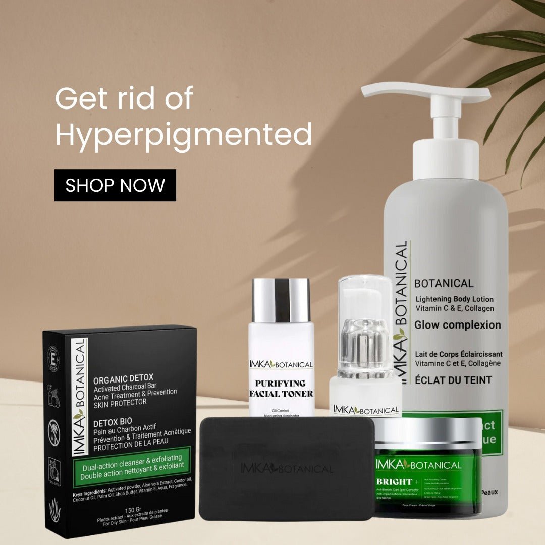 Anti - Blemish cream, Dark Spot Corrector, Hyperpigmentation cream set - ShanShar Beauty : The world of beauty.
